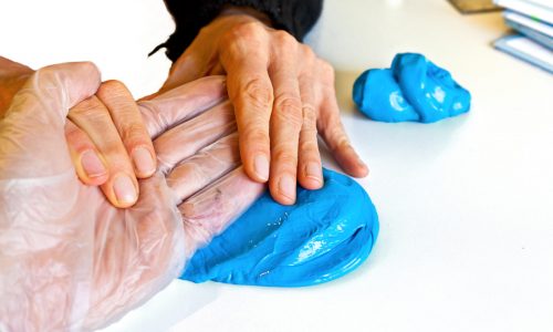 hand physiotherapy to recover a broken finder